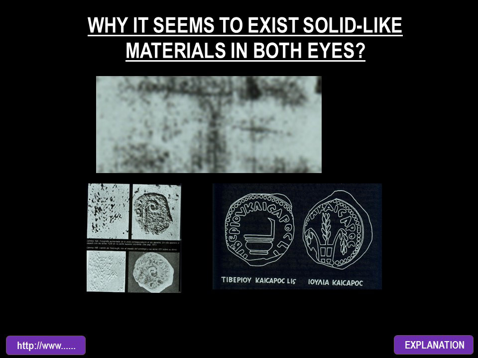 WHY IT SEEMS TO EXIST SOLID-LIKE MATERIALS IN BOTH EYES?